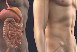 cirurgia de hérnia brasilia